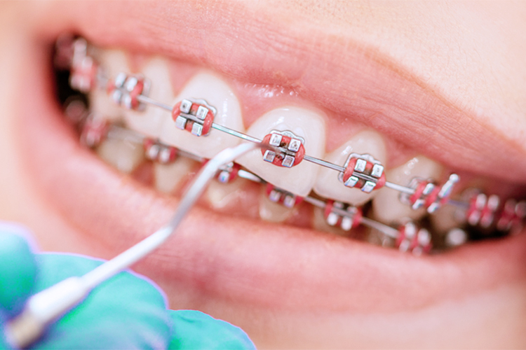 ДЕТСКАЯ И ВЗРОСЛАЯ ОТОДОНТИЯ